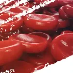 با این موادغذایی با کم خونیت خداحافظی کن